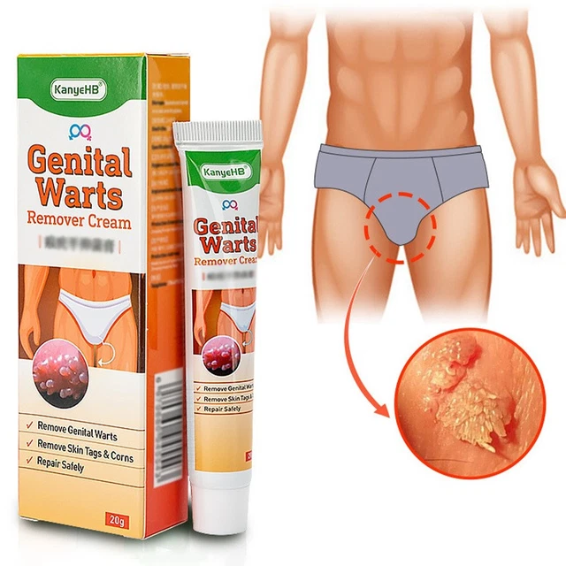 Pommade Anti-verrues Génitales Lakulish 100g - Crème Naturelle Indienne - Neuf