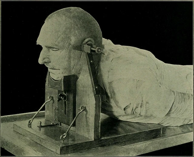 Antique Autopsy Photo 126b Oddleys Strange & Bizarre