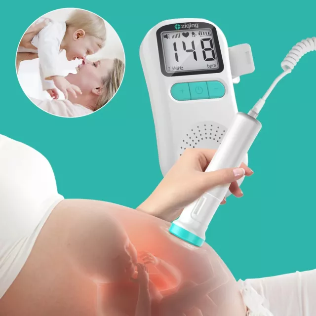 Detector de latido Fetal Doppler de 3,0 MHz para bebé, monitor de ritmo cardíaco