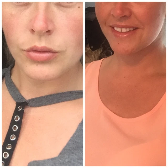 BE BRONZED STRONG Nasal Tanner Tanning Spray 99.9 Purity Amazing Tan