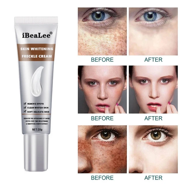 crema para aclarar la cara crema hidratante para aclarar el acné