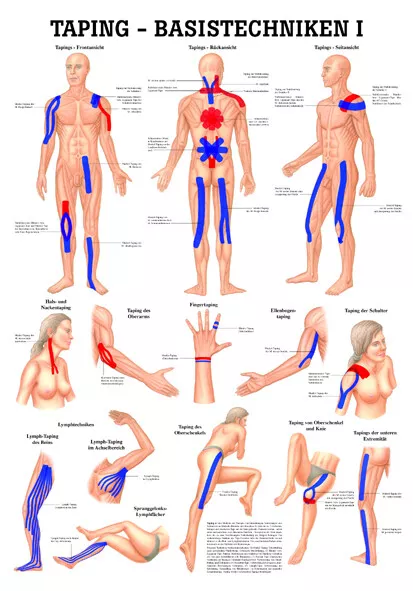 Taping - Basistechniken 1 (Lehrtafel 70Cm X 100Cm) von Rüdiger Anatomie