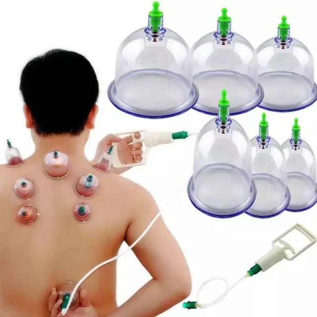 Tassen + Saugpumpe SET Körper Gesundheit Schröpftherapie Hijama Akupun L6B8☃