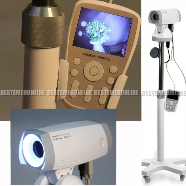 Clinic Hospital Electronic Video Colposcope Camera 830,000pixels Software Tripod