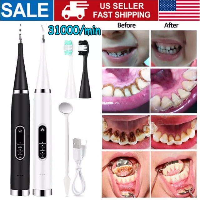 Ultrasonic Electric Tooth Cleaner Plaque Stains Remover Teeth Whitening Gel Pen