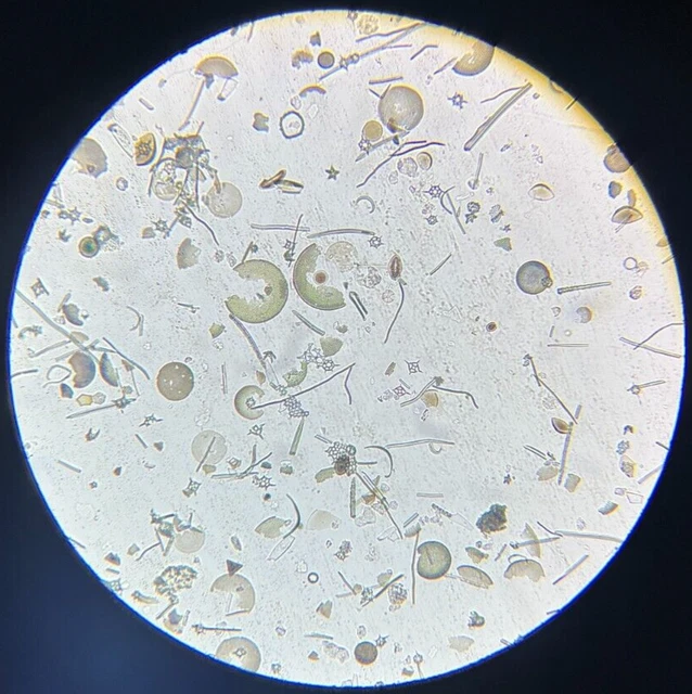 J.D. Moller Microscope Slide Diatom Fossil Moron Earth Spain Gold Medal 1869