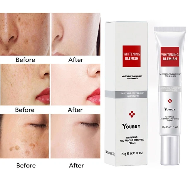 Crema blanqueadora para eliminar pecas corrector de manchas oscuras crema cuidado facial