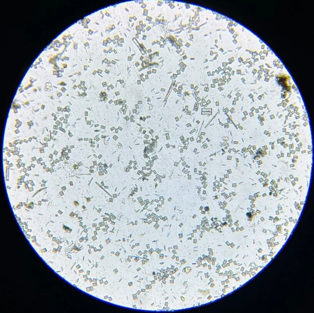 19th c J.D. Moller Microscope Slide Diatom England Toxonidea Insignis Donk.