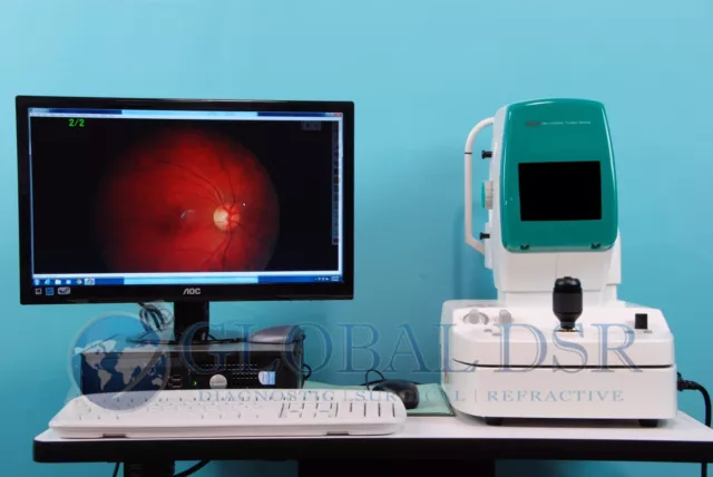 Kowa a-D Non-Mydriatic Retinal Fundus Camera