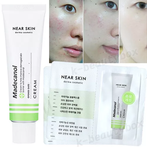 MISSHA Near Skin Madecanol Cream 50ml / For acne & blemish skin, Sensitive Skin