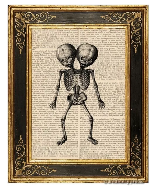 Siamese Twins Skeleton Art Print on Vintage Book Page Home Office Decor Gifts