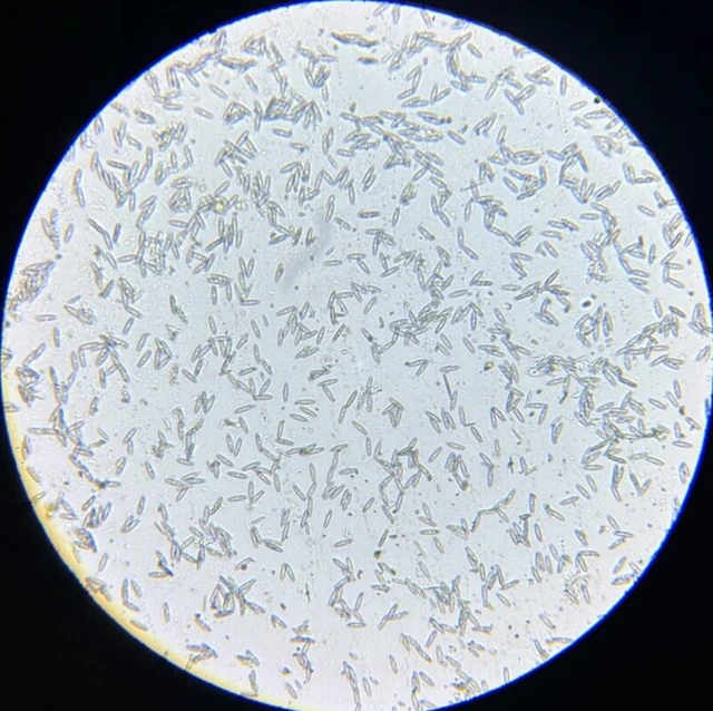 19th c J.D. Moller Microscope Slide Diatom Holstein Germany Colletonema Vulgare