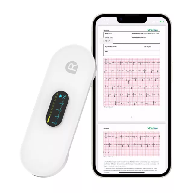 Wellue Mobile ECG Monitor 30s-5mins ECG Recording with Free APP for iOS/Android