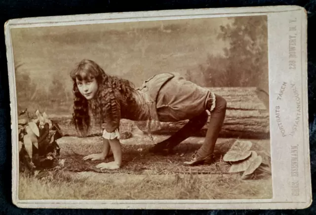1870'S Authentic Photograph Of The Camel Lady Deformity Subject Cabinet Card!!