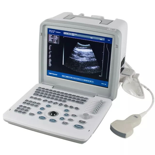 Portable Digital Ultrasound Scanner Machine Obstetric Ultrasound Convex Probe 3D 3