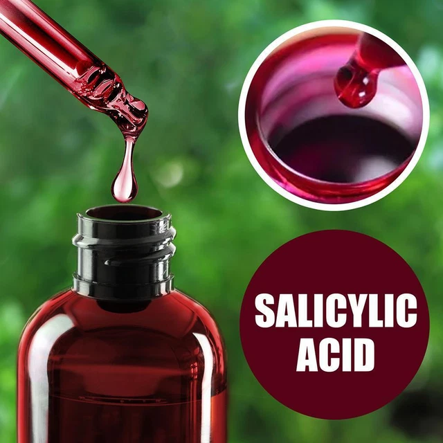 30 ml soluzione peeling viso siero esfoliante antiacne acido salicilico BST