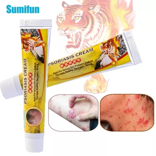 New 20g Skin Care Bacteriostasis Dermatitis Eczema Body Psoriasis All Body Cream