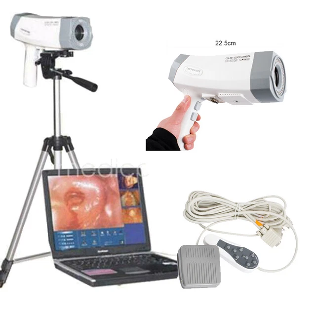 CE Electronic Colposcope 800000 Pixels Camera Gynaecology+Tripod Medical
