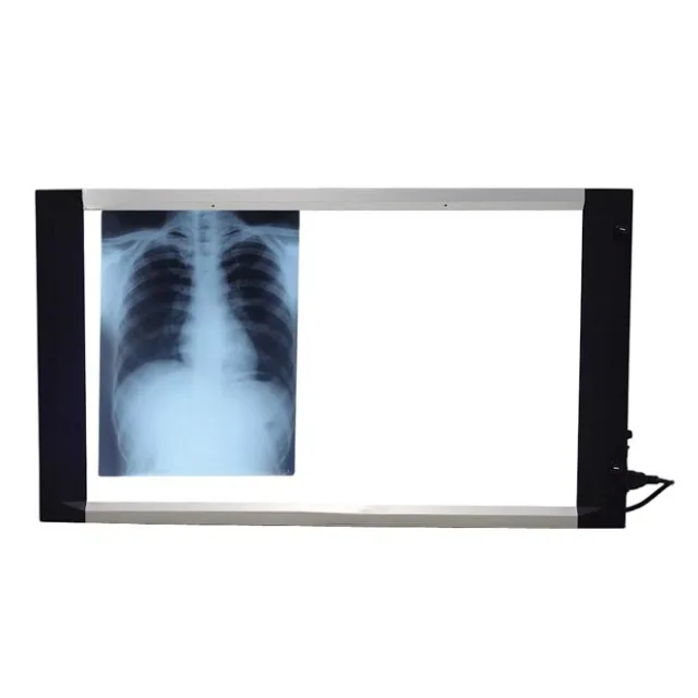 Slim LED X Ray View Box (25mm Thickness) With Dimmer & Sensor - DOUBLE Film