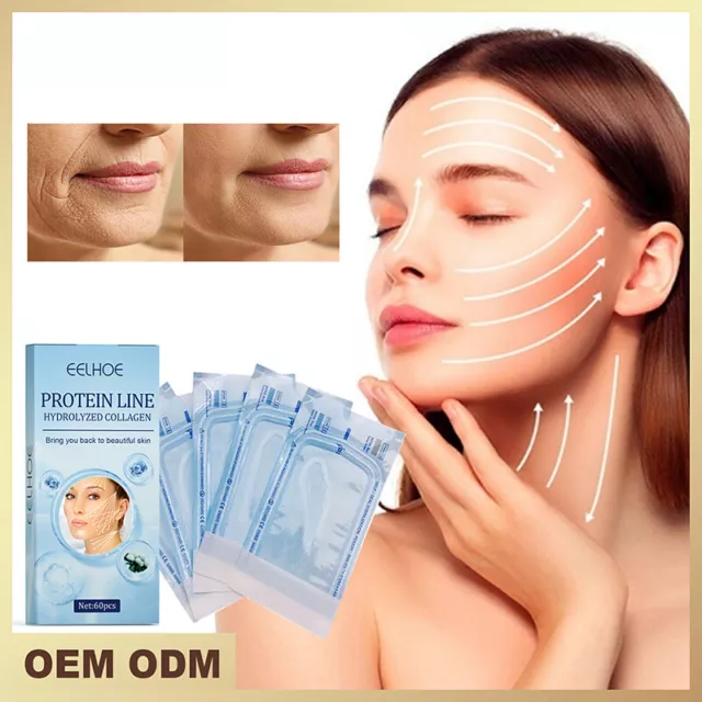 60 linee proteiche filo senza ago, linea seta fibroina essenza collagene filo