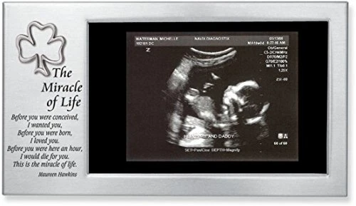Cathedral Art Miracle of Life Shamrock Baby Frame Abbey & CA Gift