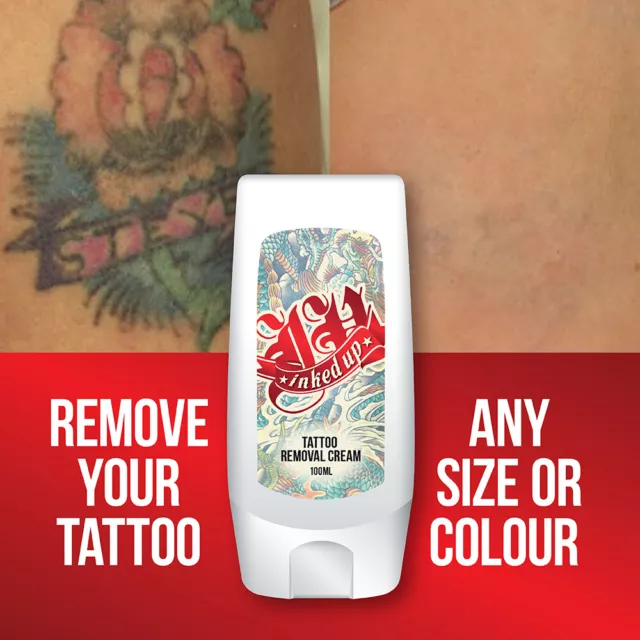 Inked Up Tattoo Removal Cream – No Need For Laser Removal Max Strength