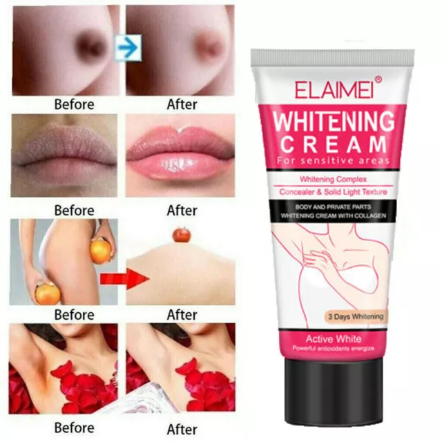 Crema sbiancante pelle sbiancante max amido per sbiancante più bianco per viso e corpo