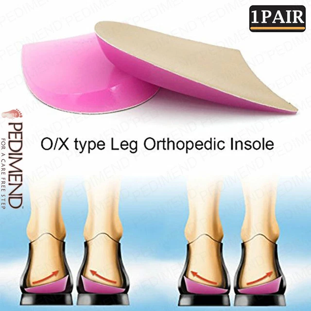 Pedimend 2 Pairs Silicone O/X Type Legs Correction Insole | Correct Pedimend 2 Pairs Silicone O/X Type Legs Correction Insole | Correct