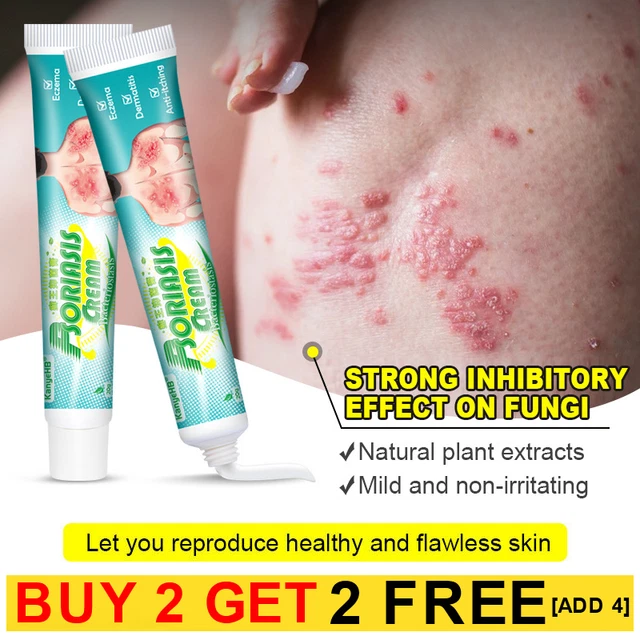 SKIN OINTMENT PSORA Skin Disease Pruritus Treatments Cream Allergy