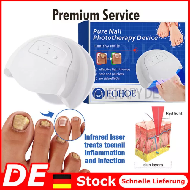 Purenail Fungus Laser Therapy Device, Light Therapy Device Fungal Nail