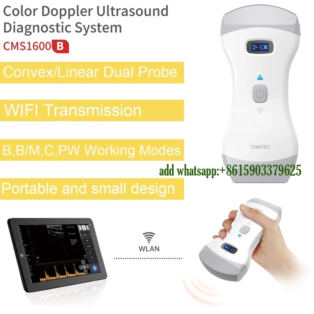 Scanner à Ultrasons Ophtalmique AIST RW-1000 - Sans Fil, Portable - Scanners Optiques A/B - Neuf Avec Garantie