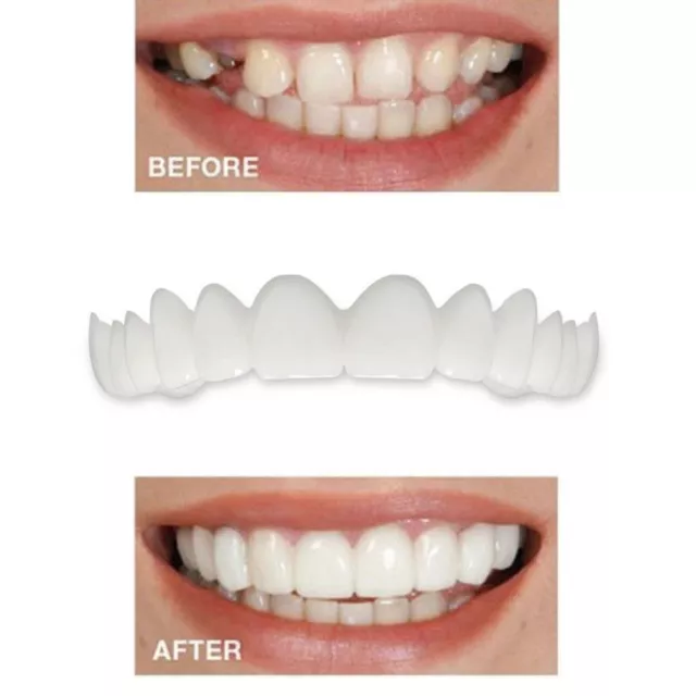 Smile Teeth Veneers Comfort Fit Flex Cosmetic Dentistry Snap On Instant Perfect