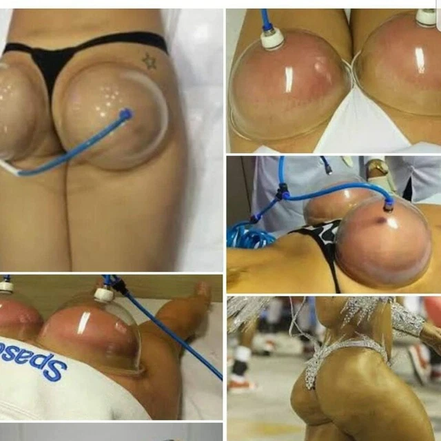 Dispositivo de terapia de succión de aspiración con bomba de mejora de glúteos de mama para ventosas