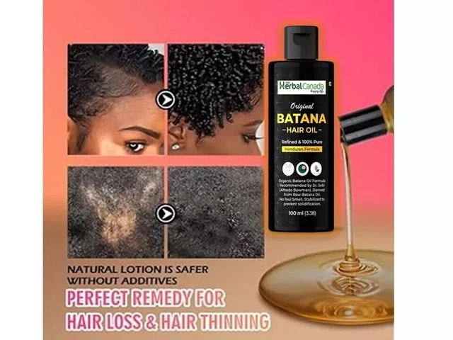 Huile De Batana Bio Honduras 100% - Croissance Cheveux 3.4 Fl Oz