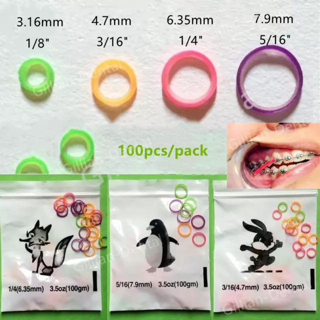 Dental Orthodontic Supper Elastic Rubber Bands Colorful Dentist Material