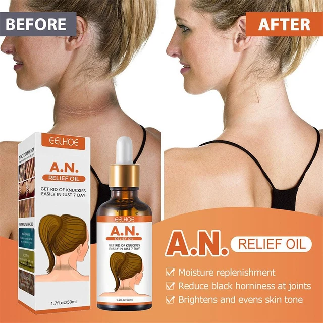 Masaje de aceite esencial terapia de aceite esencial para ennegrecer el cuerpo gotas blanqueador;