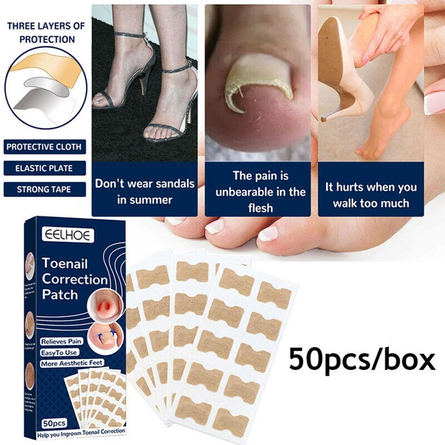 INGROWN TOENAIL CORRECTOR Stickers Paronychia Treatment Toe Nail Care ...