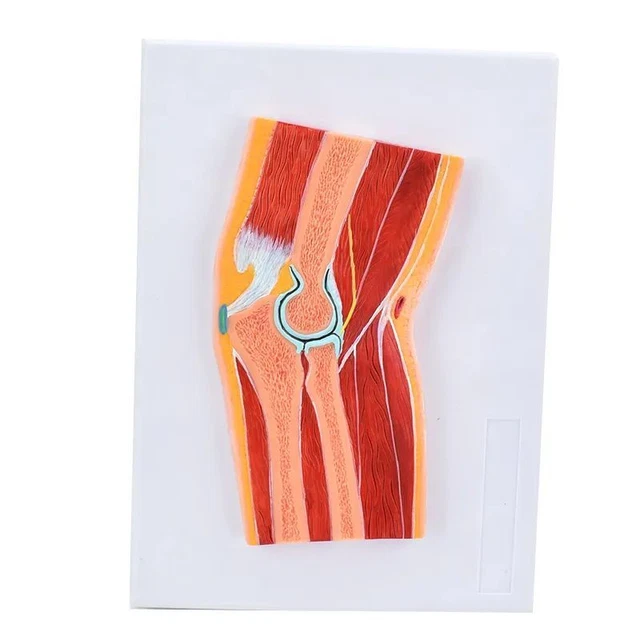 Human Elbow Joint Skeleton Muscle Cross Section Anatomy Model Biology Teaching