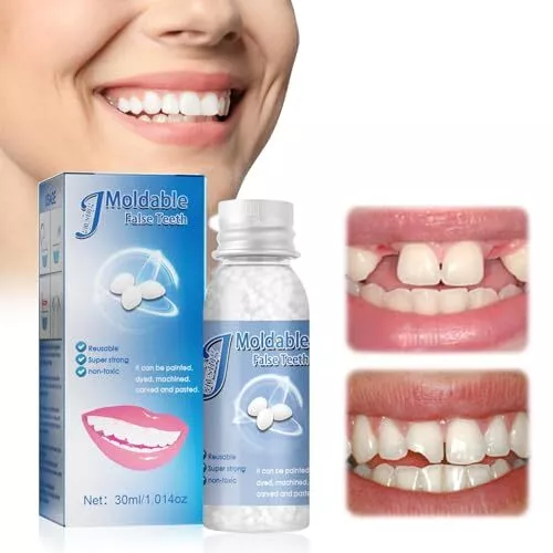 Dent Provisoire 30g Kit Réparation Dentaire Perles Solides Dentaires Pansemen...