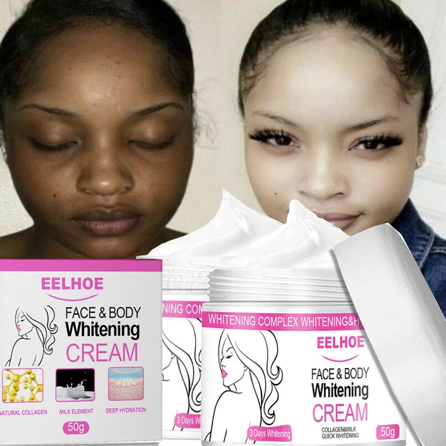 3 DAYS DARK Skin Permanent Bleaching Cream Whitening Brightening