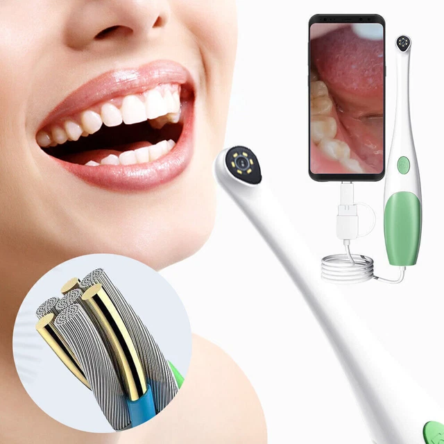 Dental Oral Intraoral Camera with USB Oral LED Light Type-c Interface Adapter