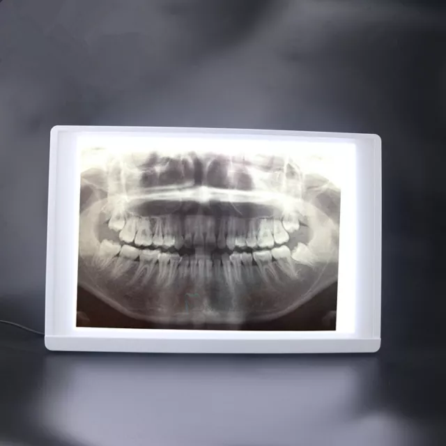 Dental LED X-Ray Film Viewer Panoramic Negatoscope LED Illuminator View Box