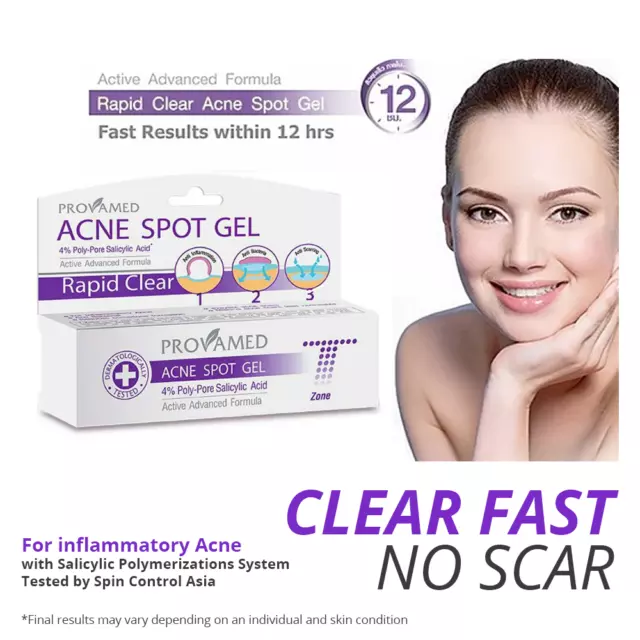 Inflammatory Acne Treatment Gel Cream FAST RELIEF Cystic Pimple Clear Face Skin