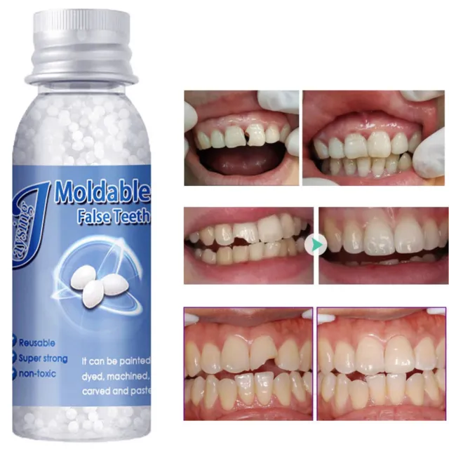 Tooth Repair Granules, Temporary Moldable Dental Pellets, Moldable False Teeth