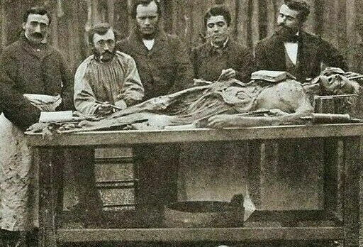 Antique Medical Autopsy Photo 1026b Oddleys Strange & Bizarre