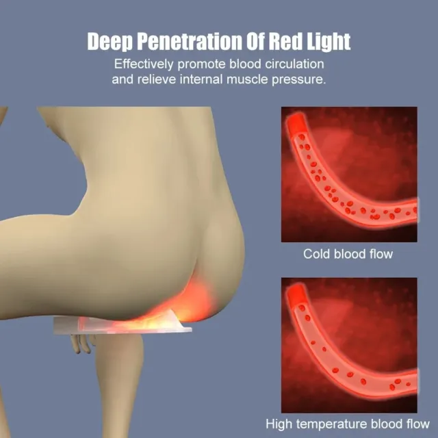 Hemorrhoid Hemorrhoids Treatment Device Hemorrhoid Removal Red Light Therapy