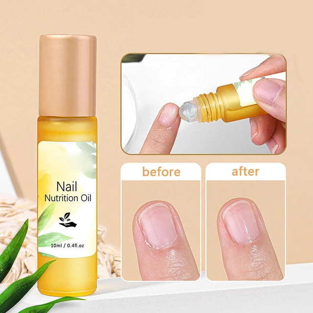 10 ml Aceite de cutícula de uñas Gel Arte en uñas Tratamiento Manicura Reparación Nutrición ~~