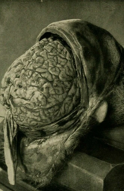 Antique Autopsy Photo 128b Odd Strange & Bizarre