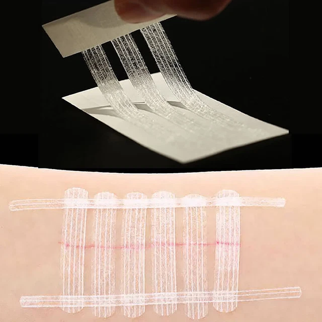 STERILE WOUND CLOSURE Medical Surgical Tape Suture Free Skin Closure ...