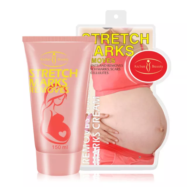 Aichun Pregnancy Cream Streach Mark Remover Scars Repair Cellulites Lotion 150ml